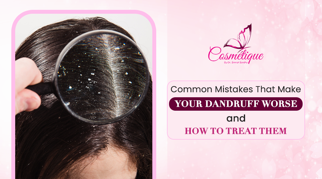Common Mistakes That Make Your Dandruff Worse and How to Treat Them